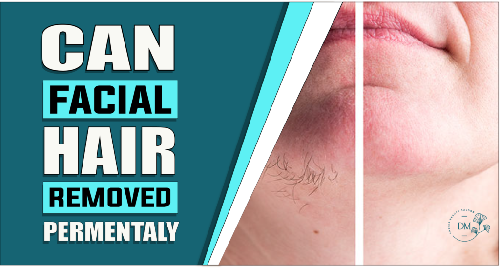Can Facial Hair Be Removed Permanently