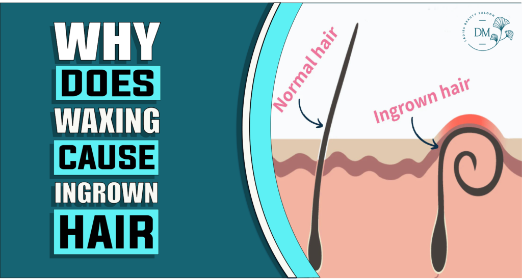 Why Does Waxing Cause Ingrown Hairs | Reveal the Facts
